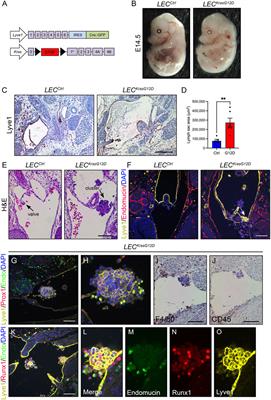 Hyperactive KRAS/MAPK signaling disrupts normal lymphatic vessel architecture and function
